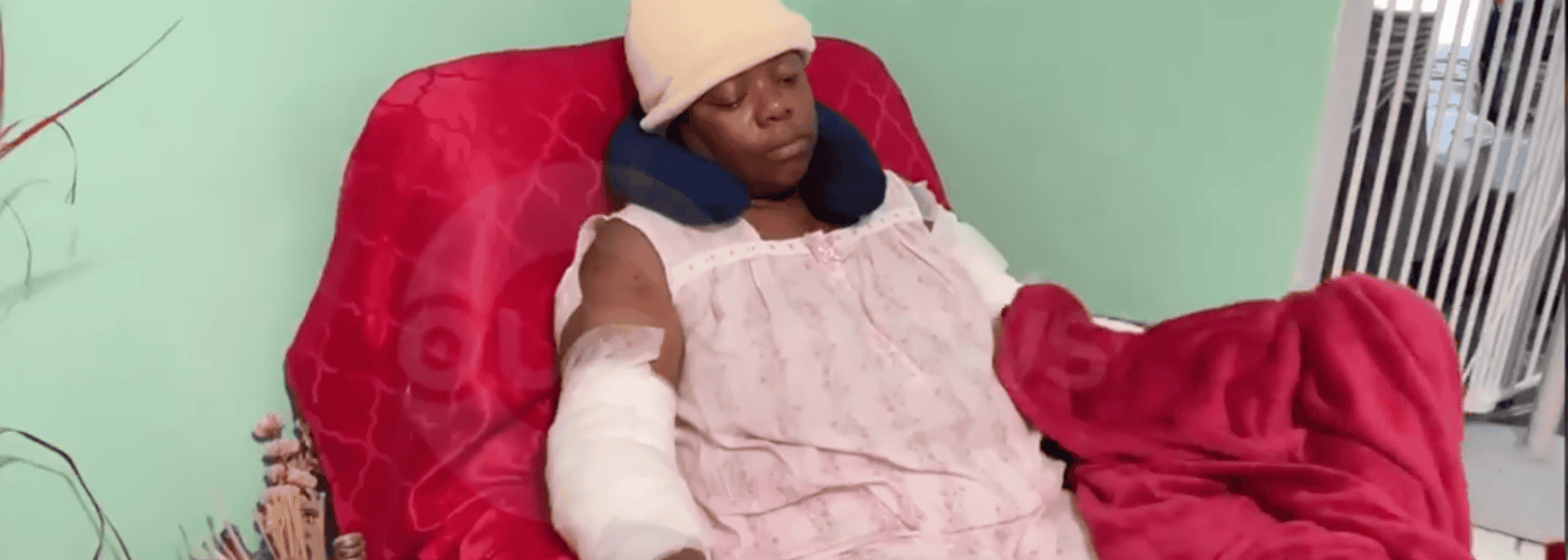 Woman Speaks Out After Vicious Dog Attack - Our News