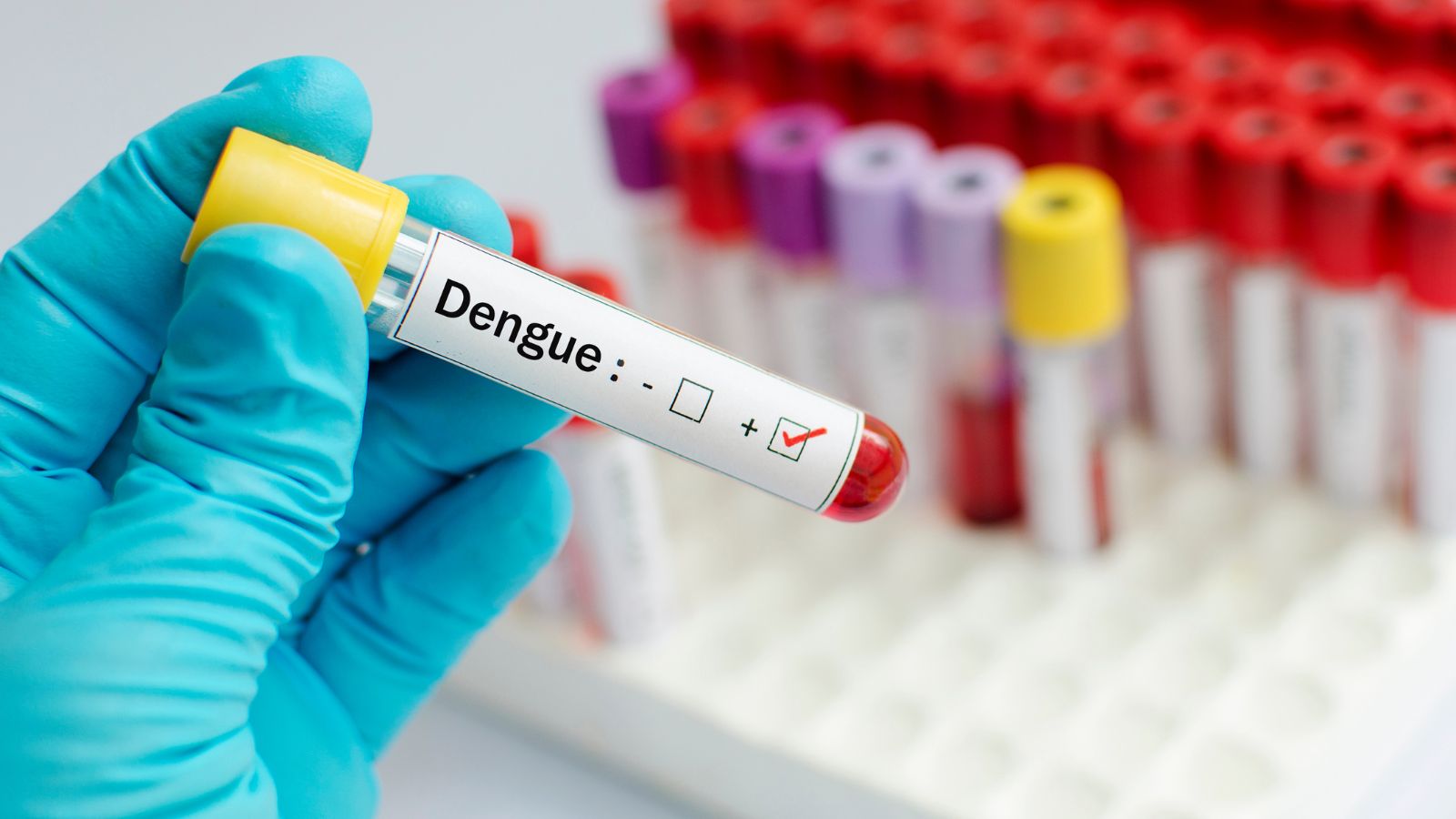 Guyana: School Children Die From Dengue - Our News